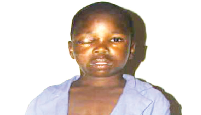 Hoodlums remove 12-year-old studentâ€™s eye, police hunt suspects
