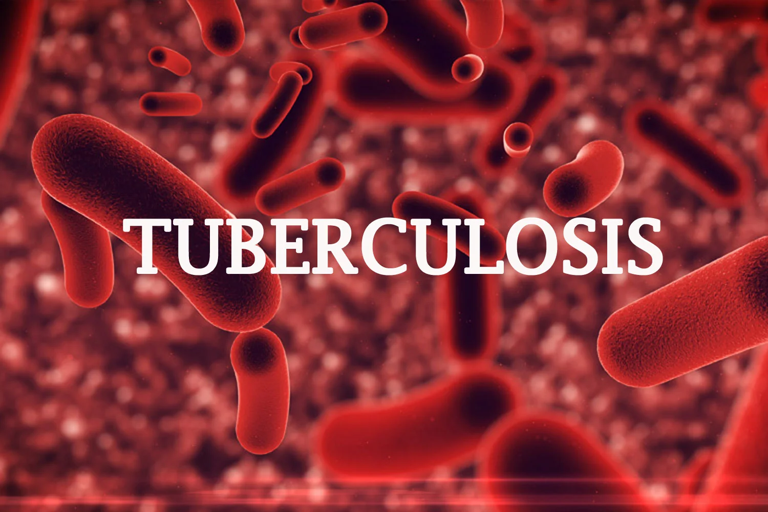 Tuberculosis: Donâ€™t sleep in same room with others â€“ Expert to patients