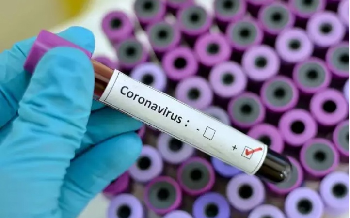BREAKING: Six COVID-19 Patients Recovers, To Be Discharged In Lagos