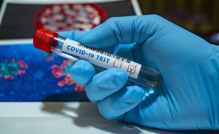 Medical council validates four coronavirus test kits â€“ registrar