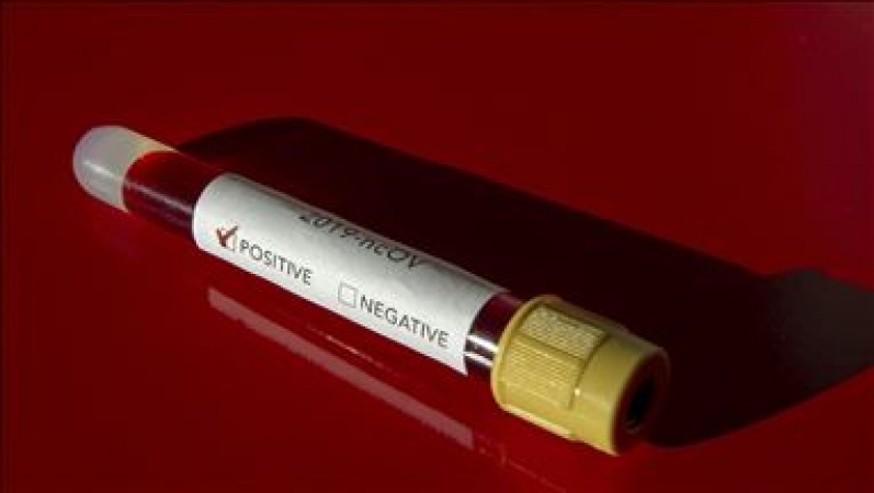 2,430 virus patients decline to show up for treatment 