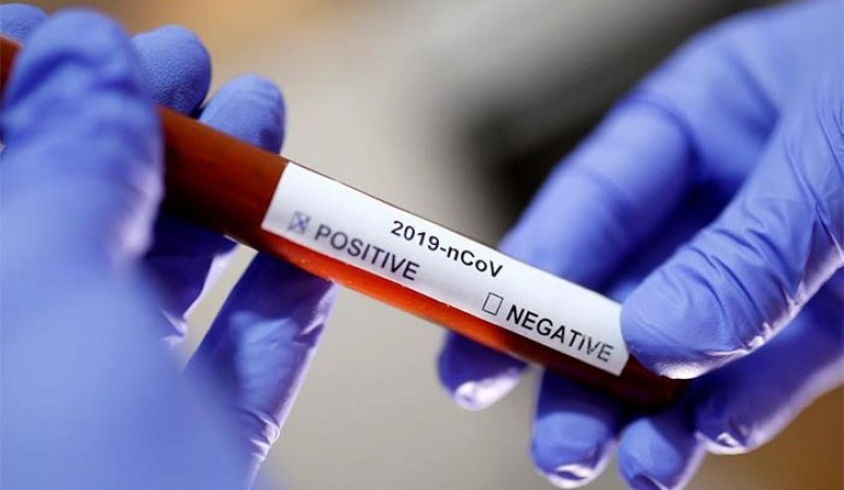 Lagos shuts down illegal coronavirus lab in Ikoyi
