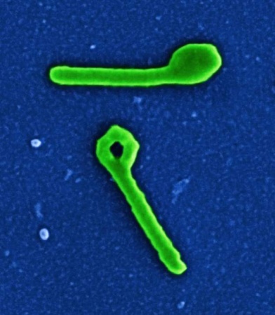 DR Congo confirms third Ebola case