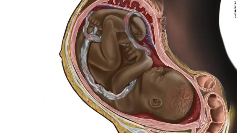 A viral image of a Black fetus is highlighting the need for diversity in medical illustrations