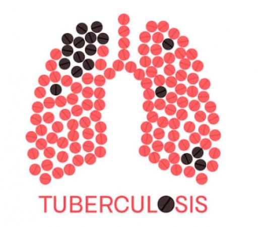 â€˜73% Nigerians ignorant of TB diseaseâ€™