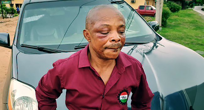 â€˜I Canâ€™t Explain The Beatingâ€™: NLC President Ajaero Narrates Ordeal In Imo