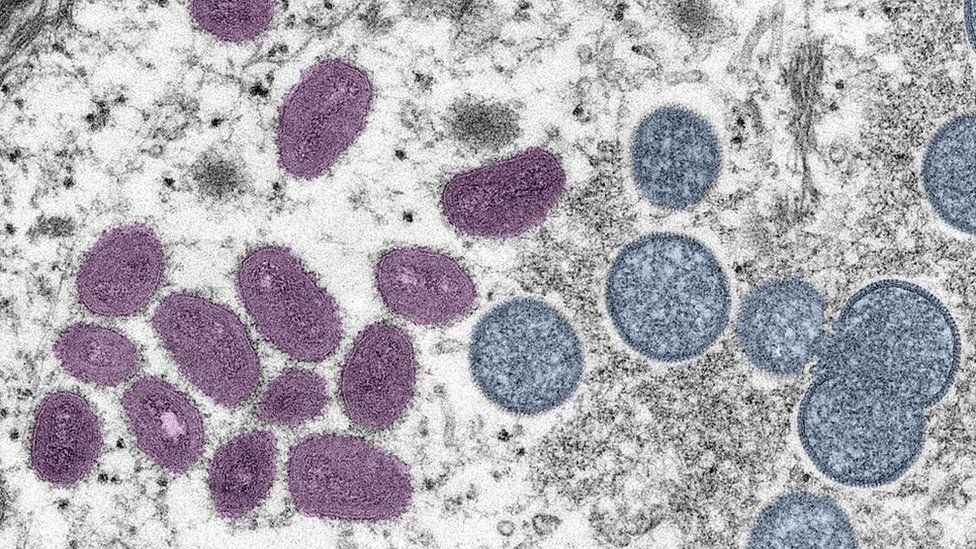 Monkeypox: US confirms first two cases in children